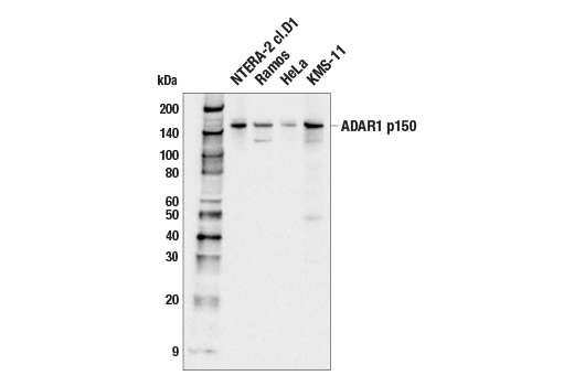 Western Blotting Image 2: ADAR1 p150 Isoform Antibody