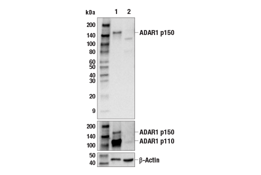 Western Blotting Image 1: ADAR1 p150 Isoform Antibody