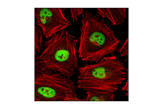 Immunofluorescence Image 1: AP-2α (C83E10) Rabbit mAb