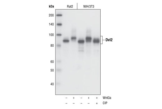  Image 12: Wnt Signaling Antibody Sampler Kit