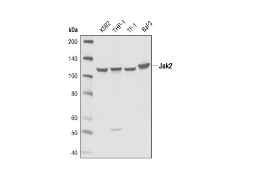  Image 4: PhosphoPlus® Jak2 (Tyr1007/Tyr1008) Antibody Duet