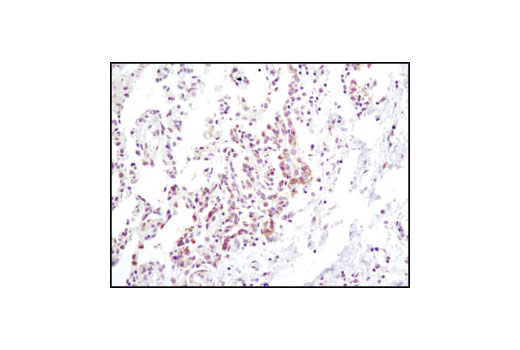  Image 27: IFN-γ Signaling Pathway Antibody Sampler Kit