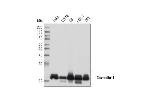 Western Blotting Image 1: Caveolin-1 Antibody