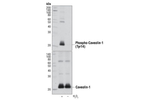 Western Blotting Image 1: Phospho-Caveolin-1 (Tyr14) Antibody