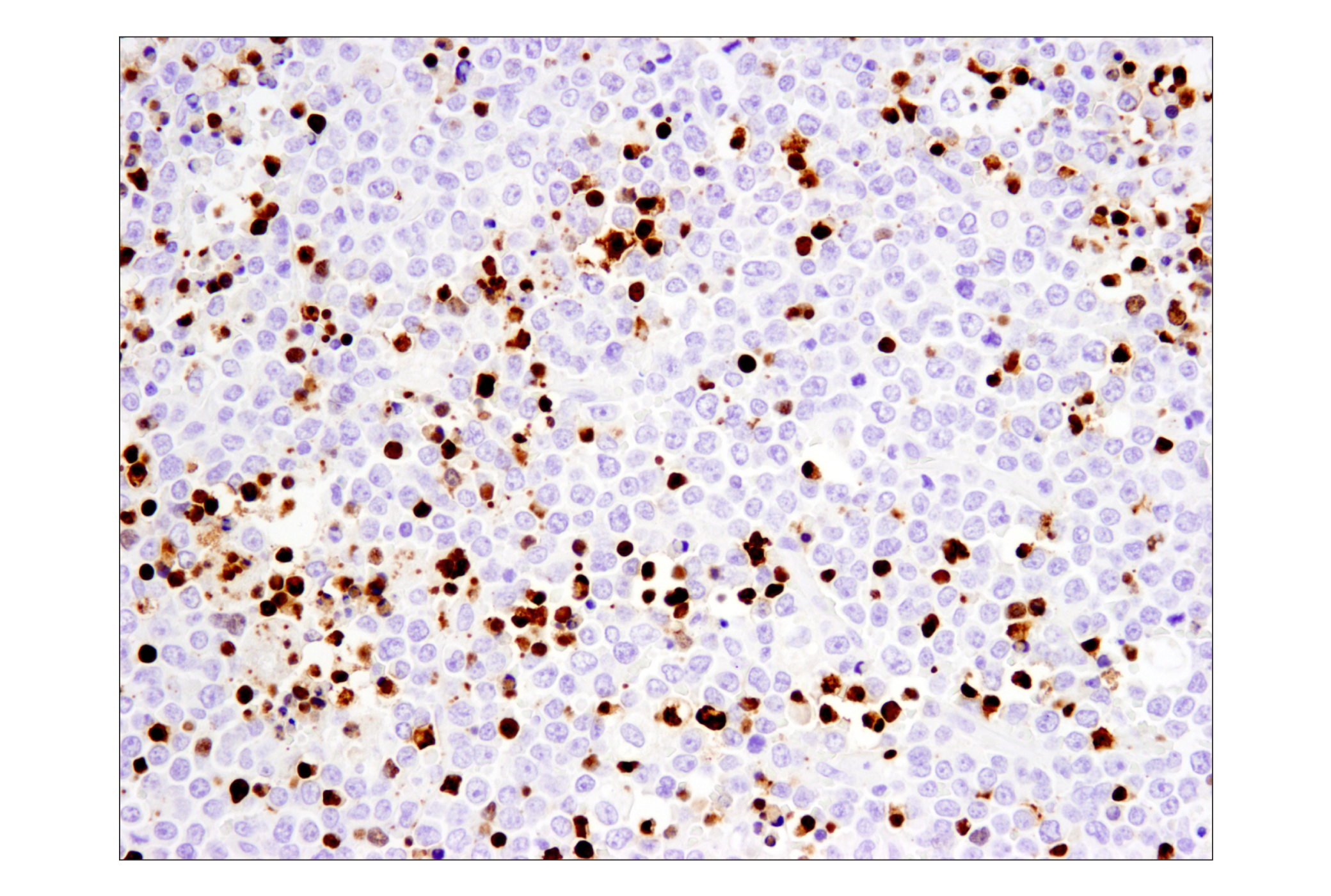 Immunohistochemistry Image 3: Cleaved-PARP (Asp214) (E2T4K) Mouse mAb
