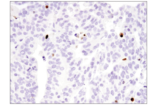  Image 32: Apoptosis Antibody Sampler Kit II