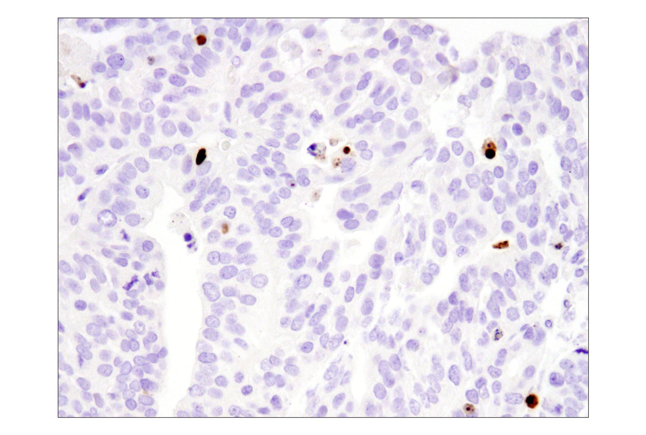 Immunohistochemistry Image 4: Cleaved-PARP (Asp214) (E2T4K) Mouse mAb