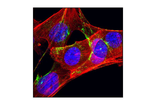 Immunofluorescence Image 4: Caveolin-1 (D46G3) XP® Rabbit mAb