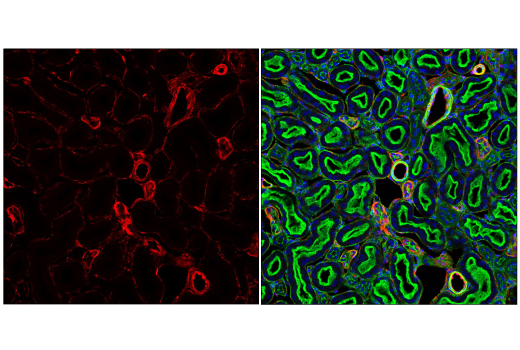 Immunofluorescence Image 2: Caveolin-1 (D46G3) XP® Rabbit mAb