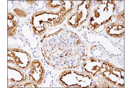  Image 25: Coronavirus Host Cell Attachment and Entry Antibody Sampler Kit