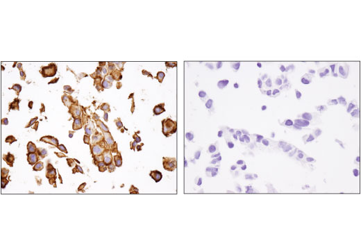 Immunohistochemistry Image 3: CD13/APN (D6V1W) Rabbit mAb