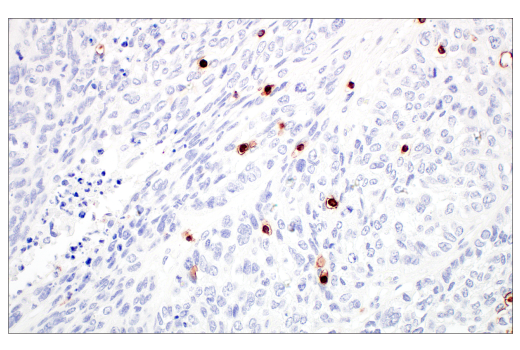 Immunohistochemistry Image 6: CD7 (E4G1Q) XP® Rabbit mAb (BSA and Azide Free)