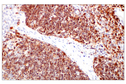 Immunohistochemistry Image 8: CD7 (E4G1Q) XP® Rabbit mAb (BSA and Azide Free)