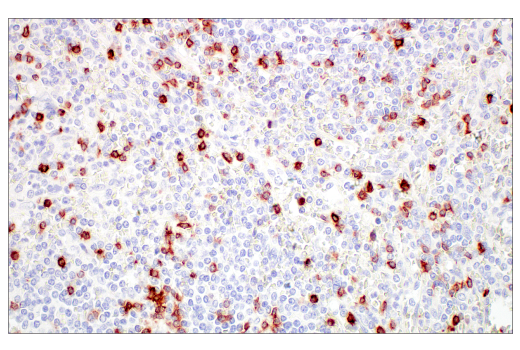 Immunohistochemistry Image 13: CD7 (E4G1Q) XP® Rabbit mAb (BSA and Azide Free)