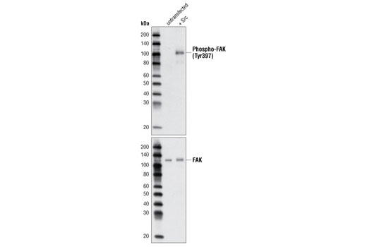Western Blotting Image 1: Phospho-FAK (Tyr397) Antibody