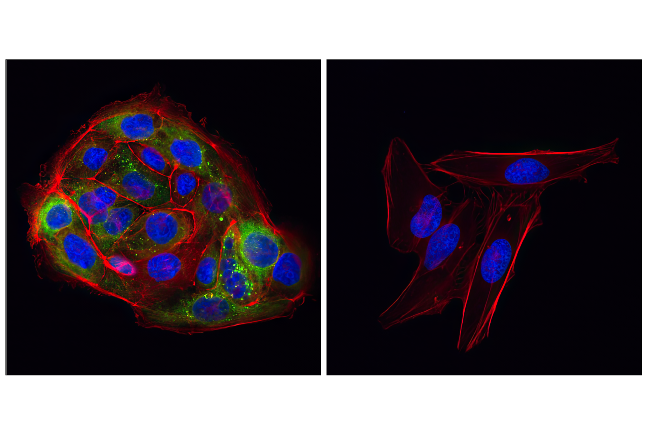 Immunofluorescence Image 1: ROS1 (D4D6®) Rabbit mAb