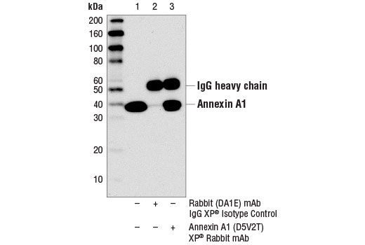 Immunoprecipitation Image 1: Annexin A1 (D5V2T) XP® Rabbit mAb