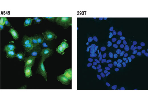 Immunofluorescence Image 1: Annexin A1 (D5V2T) XP® Rabbit mAb