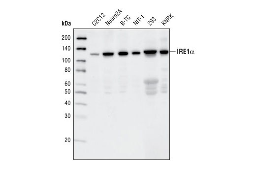  Image 6: ER Homeostasis Antibody Sampler Kit