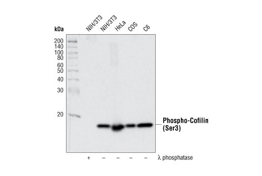  Image 13: Cofilin Activation Antibody Sampler Kit
