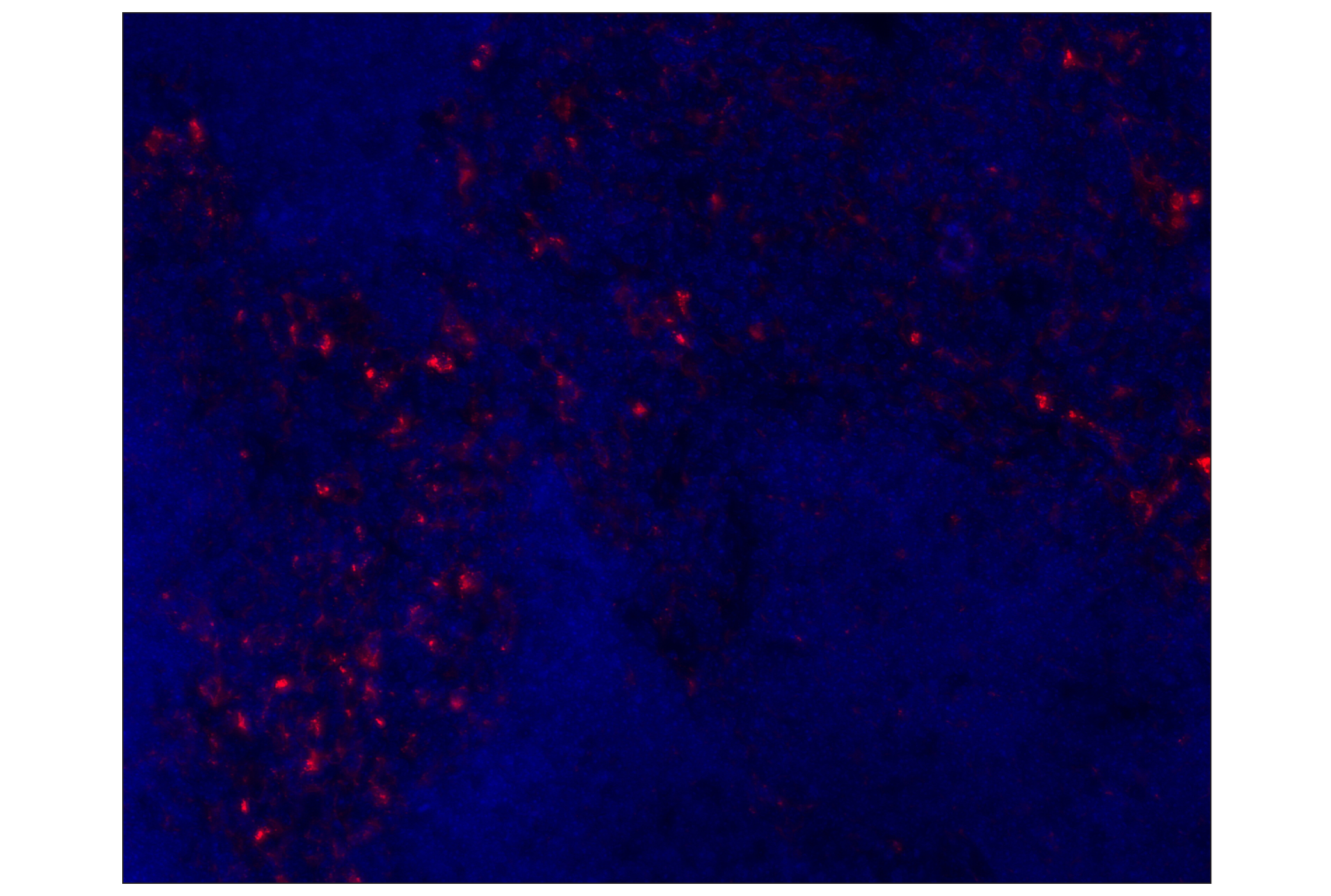 Immunohistochemistry Image 1: PD-L1 (D5V3B) Rabbit mAb (Alexa Fluor® 647 Conjugate)