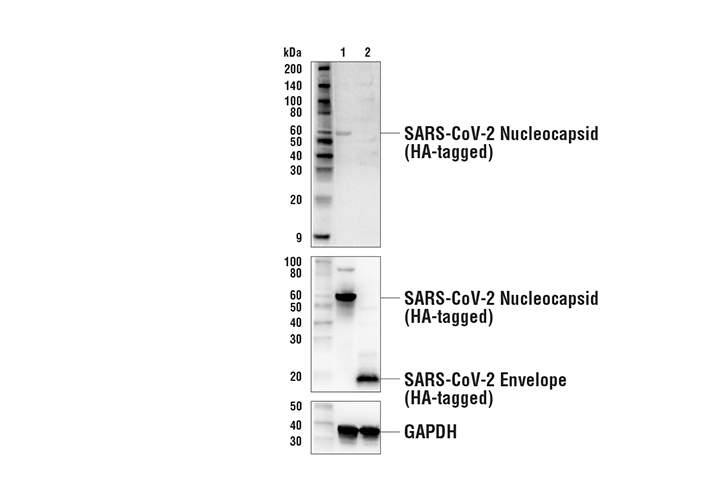 Western Blotting Image 2: SARS-CoV-2 Nucleocapsid Protein Antibody
