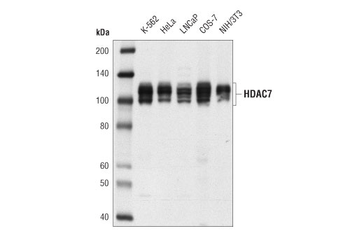  Image 4: Class II HDAC Antibody Sampler Kit
