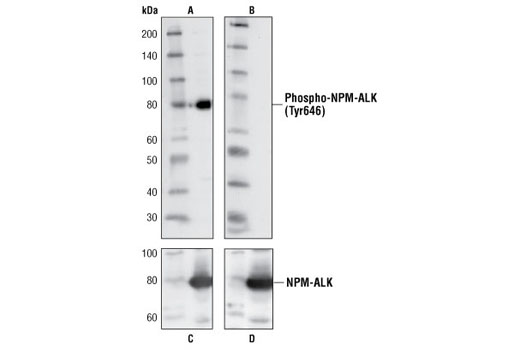 Western Blotting Image 2: Phospho-ALK (Tyr1586) Antibody