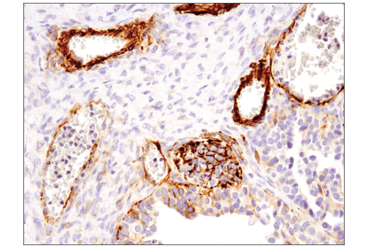 Immunohistochemistry Image 5: Nestin (10C2) Mouse mAb