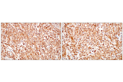 Immunohistochemistry Image 7: Nestin (10C2) Mouse mAb