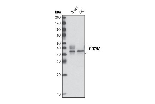 Western Blotting Image 1: CD79A Antibody