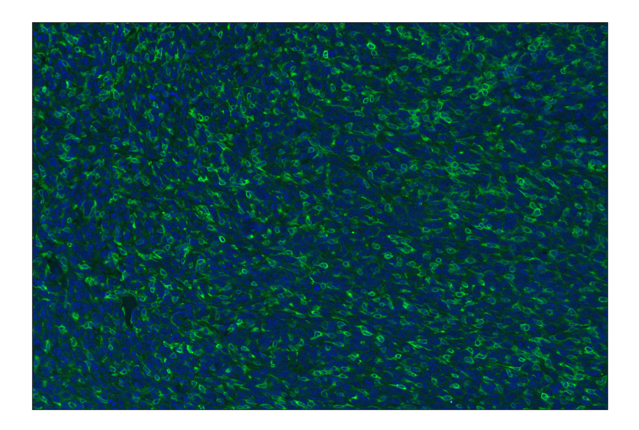 Immunohistochemistry Image 1: CD11b/ITGAM (E4K8C) Rabbit mAb (Alexa Fluor® 488 Conjugate)