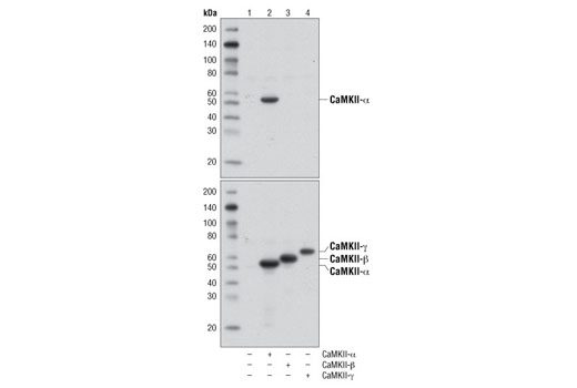 Western Blotting Image 1: CaMKII-α Antibody
