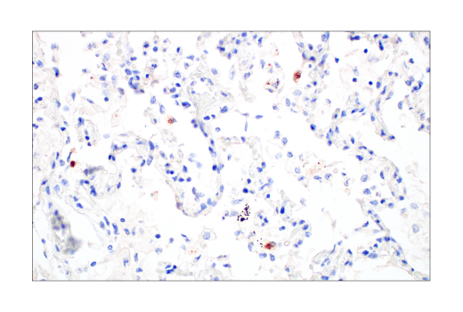 Immunohistochemistry Image 1: SARS-CoV-2 Nucleocapsid Protein (E8R1L) Mouse mAb