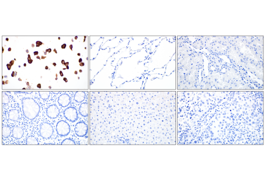 Immunohistochemistry Image 3: SARS-CoV-2 Nucleocapsid Protein (E8R1L) Mouse mAb