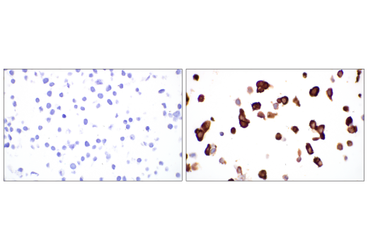Immunohistochemistry Image 5: SARS-CoV-2 Nucleocapsid Protein (E8R1L) Mouse mAb