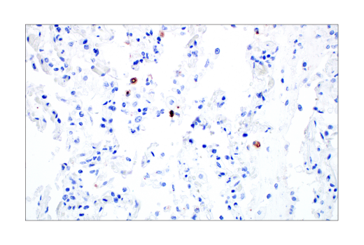 Immunohistochemistry Image 6: SARS-CoV-2 Nucleocapsid Protein (E8R1L) Mouse mAb