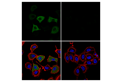Immunofluorescence Image 1: SARS-CoV-2 Nucleocapsid Protein (E8R1L) Mouse mAb