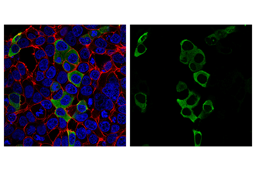 Immunofluorescence Image 2: SARS-CoV-2 Nucleocapsid Protein (E8R1L) Mouse mAb