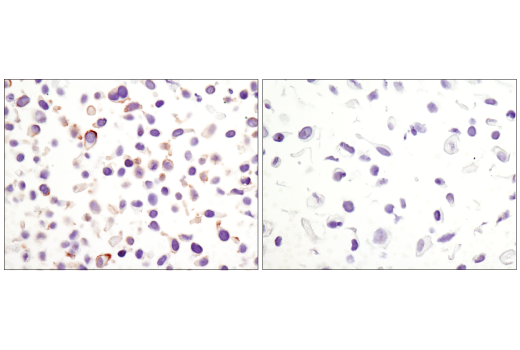 Immunohistochemistry Image 4: Non-phospho (Active) β-Catenin (Ser33/37/Thr41) (D13A1) Rabbit mAb (BSA and Azide Free)