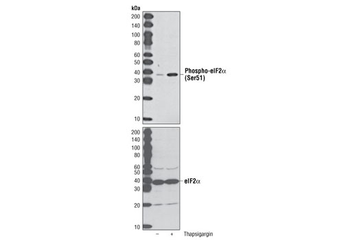  Image 7: ER Homeostasis Antibody Sampler Kit