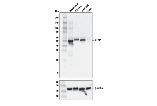  Image 3: β-Amyloid Mouse Model Neuronal Viability IF Antibody Sampler Kit