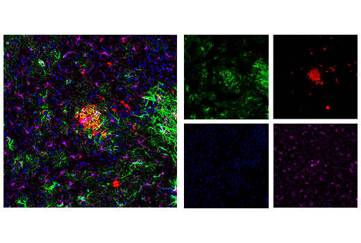  Image 26: β-Amyloid Mouse Model Neuronal Viability IF Antibody Sampler Kit