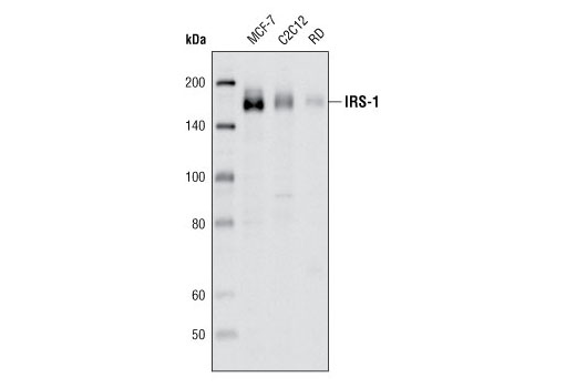  Image 3: Insulin Receptor Substrate Antibody Sampler Kit