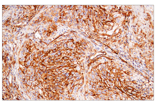 Immunohistochemistry Image 3: CD141/Thrombomodulin (E7Y9P) XP® Rabbit mAb (BSA and Azide Free)