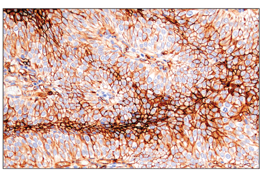 Immunohistochemistry Image 1: CD141/Thrombomodulin (E7Y9P) XP® Rabbit mAb (BSA and Azide Free)