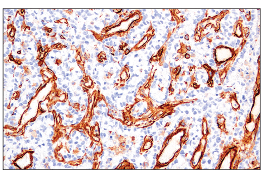 Immunohistochemistry Image 2: CD141/Thrombomodulin (E7Y9P) XP® Rabbit mAb (BSA and Azide Free)
