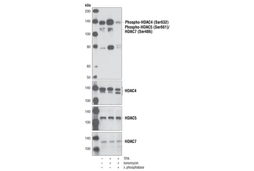 Phospho-HDAC4 (Ser632)/HDAC5 (Ser661)/HDAC7 (Ser486) Antibody 