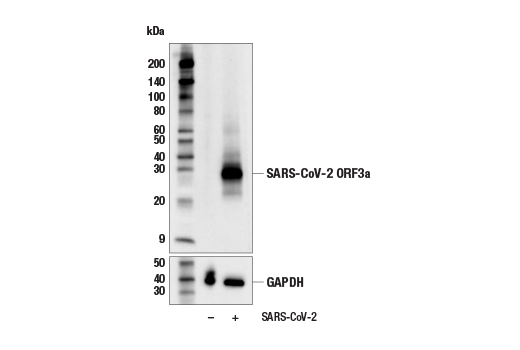 Western Blotting Image 1: SARS-CoV-2 ORF3a Antibody
