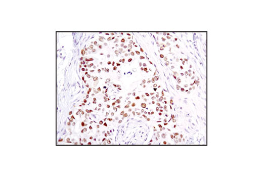 Immunohistochemistry Image 1: Chk2 (1C12) Mouse mAb